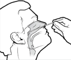 鼻咽頭ぬぐい液でのPCR検査